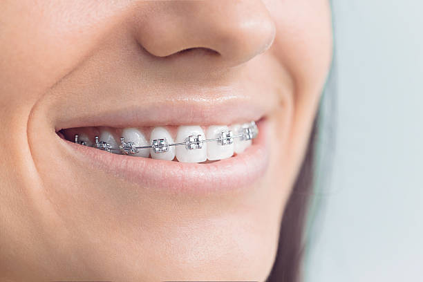 Why Choose Us for Your Dental Needs in Lincoln, AL